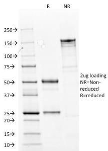 SDS-PAGE analysis of Anti-Cytokeratin 14 Antibody [LL002] under non-reduced and reduced conditions; showing intact IgG and intact heavy and light chains, respectively. SDS-PAGE analysis confirms the integrity and purity of the antibody