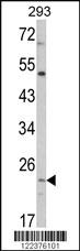 Anti-ATP5O Rabbit Polyclonal Antibody