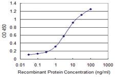 Anti-DAPK2 Mouse Monoclonal Antibody [clone: 1A2]