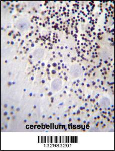 Anti-HIST1H2AB Rabbit Polyclonal Antibody (HRP (Horseradish Peroxidase))