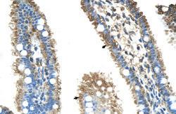 Anti-ALDH4A1 Rabbit Polyclonal Antibody