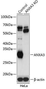 Anti-Annexin A3/ANXA3 Rabbit Polyclonal Antibody