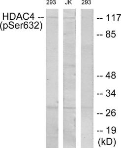 Western blot analysis of lysates from 293 cells treated with etoposide 25uM 1hour and Jurkat cells treated with etoposide 25uM 24hours using Anti-HDAC4 (phospho Ser632) Antibody. The right hand lane represents a negative control, where the antibody is blocked by the immunising peptide.