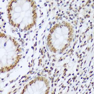 Immunohistochemistry analysis of paraffin-embedded human appendix tissue using Anti-ABL1 (phospho Tyr412) Antibody (A305660) at a dilution of 1:100 (40X lens)