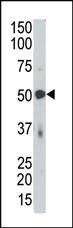 Anti-PDK4 Rabbit Polyclonal Antibody