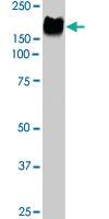 Anti-ERBB2 Rabbit Polyclonal Antibody