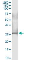 Anti-NDUFS3 Polyclonal Antibody Pair