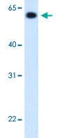 Anti-ALDH4A1 Rabbit Polyclonal Antibody