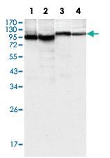 Anti-BTK Mouse Monoclonal Antibody [clone: 7F12H4]