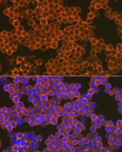 Immunofluorescence analysis of Raw264 7 cells using Anti-CD82 Antibody [ARC1501] (A308137) at a dilution of 1:100 (40X lens). DAPI was used to stain the cell nuclei (blue)