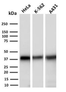 Antibody anti-AKR1C2 CPTC-AKR1C2-1 100 µg