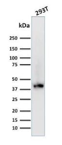 Western blot analysis of human 293T cell lysate using Anti-BMI1 Antibody [BMI1/2689]