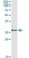 Anti-EFNA3 Antibody Pair