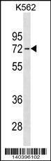 Anti-IL22RA1 Rabbit Polyclonal Antibody (AP (Alkaline Phosphatase))