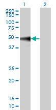 Anti-MAPK9 Mouse Monoclonal Antibody [clone: 1C1-3A8]