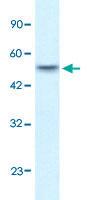 Anti-ANKRD11 Rabbit Polyclonal Antibody