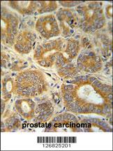 Anti-CRABP1 Rabbit Polyclonal Antibody