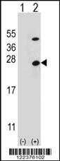 Anti-ATP5O Rabbit Polyclonal Antibody