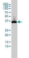 Anti-CDX2 Mouse Monoclonal Antibody [clone: 1C7]