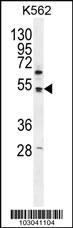 Anti-PDK4 Rabbit Polyclonal Antibody