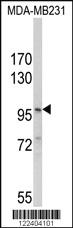 Anti-NLRP3 Rabbit Polyclonal Antibody