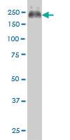 Anti-ABCC4 Mouse Monoclonal Antibody [clone: 1B2]