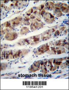 Anti-PCIA1 Rabbit Polyclonal Antibody (Biotin)