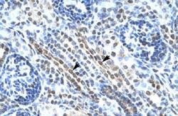 Anti-ANKRD11 Rabbit Polyclonal Antibody