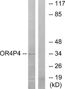 Anti-OR4P4 antibody