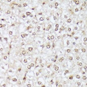 Immunohistochemistry analysis of paraffin-embedded mouse liver using Anti-ABL1 (phospho Tyr412) Antibody (A305660) at a dilution of 1:100 (40X lens)