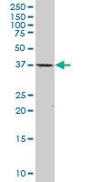 Anti-CDX2 Mouse Monoclonal Antibody [clone: 1C7]