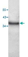 Anti-PDLIM3 Rabbit Polyclonal Antibody