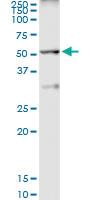 Anti-TAF6L Polyclonal Antibody Pair