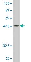 Anti-DDAH2 Mouse Monoclonal Antibody [clone: 3E3]