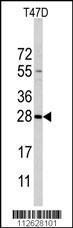 Anti-PEMT Rabbit Polyclonal Antibody (HRP (Horseradish Peroxidase))