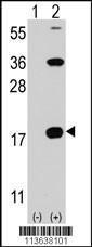 Anti-CD247 Rabbit Polyclonal Antibody (HRP (Horseradish Peroxidase))