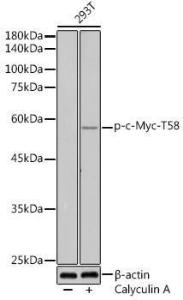 Antibody anti-MYC phospho T58 100 µl