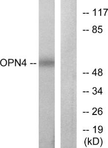 Western blot analysis of lysates from COLO cells using Anti-OPN4 Antibody. The right hand lane represents a negative control, where the antibody is blocked by the immunising peptide