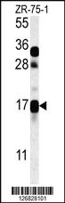 Anti-CSAG2 Rabbit Polyclonal Antibody