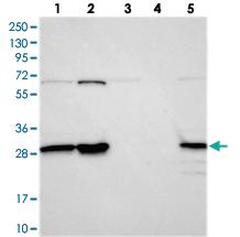 Anti-INO80E Rabbit Polyclonal Antibody