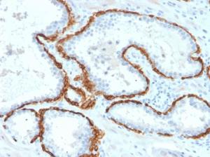 Anti-Cytokeratin 15 antibody