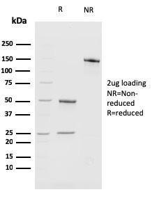 SDS-PAGE analysis of Anti-BMI1 Antibody [BMI1/2689] under non-reduced and reduced conditions; showing intact IgG and intact heavy and light chains, respectively SDS-PAGE analysis confirms the integrity and purity of the antibody