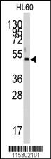 Anti-PDK4 Rabbit Polyclonal Antibody