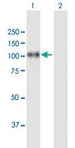 Anti-ITGB8 Mouse Polyclonal Antibody