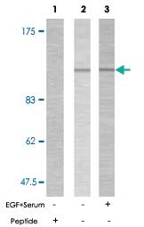 Anti-PTK2 Rabbit Polyclonal Antibody