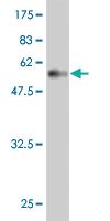 Anti-MSI2 Mouse Monoclonal Antibody [clone: 3C6]