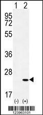 Anti-CRH Rabbit Polyclonal Antibody (Biotin)