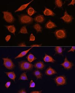 Immunofluorescence analysis of L929 cells using Anti-RIG-I / DDX58 Antibody (A309664) at a dilution of 1:100. DAPI was used to stain the cell nuclei (blue)