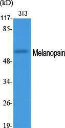 Western blot analysis of various cells using Anti-OPN4 Antibody