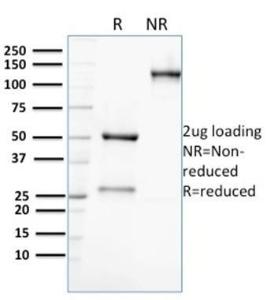 Antibody anti-AKR1C2 CPTC-AKR1C2-1 100 µg